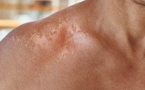 especialistas-en-dermatologia