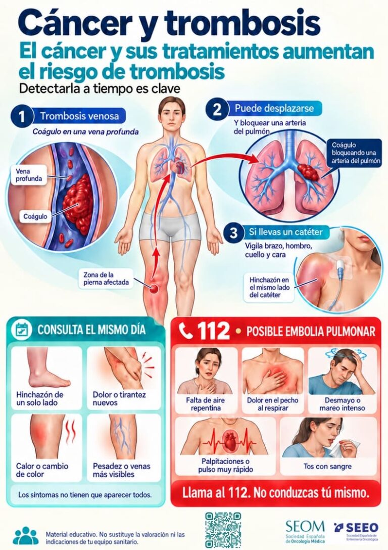 La trombosis puede aparecer en cualquier estadio del cáncer y comprometer el tratamiento oncológico